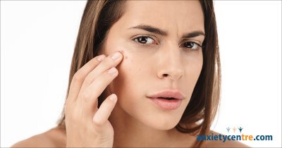 can anxiety cause acne