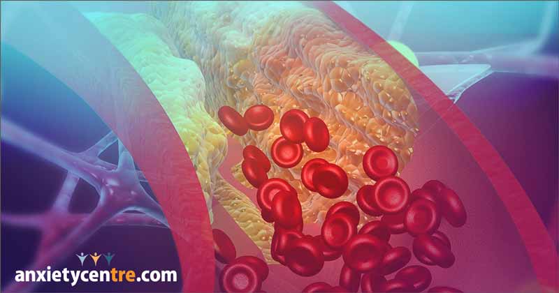 chronic pain can increase bad cholesterol (LDL)